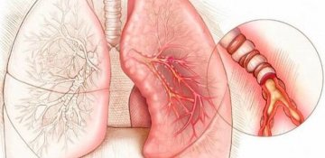 Ağ ciyərlərimizə kömək edək