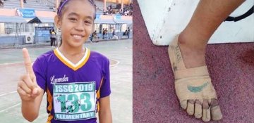 Qaçış kedi olmadı, yara bantı ilə qaçdı və birincilik qazandı - 11 yaşlı qızın qələbəsi